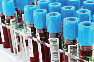 Liquid biopsy tests