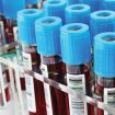 Liquid biopsy tests can identify patients for immunotherapy