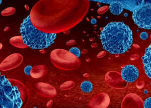 12 Blood Cancer Researchers Join Forces