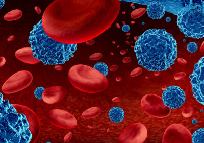 12 Blood Cancer Researchers Join Forces