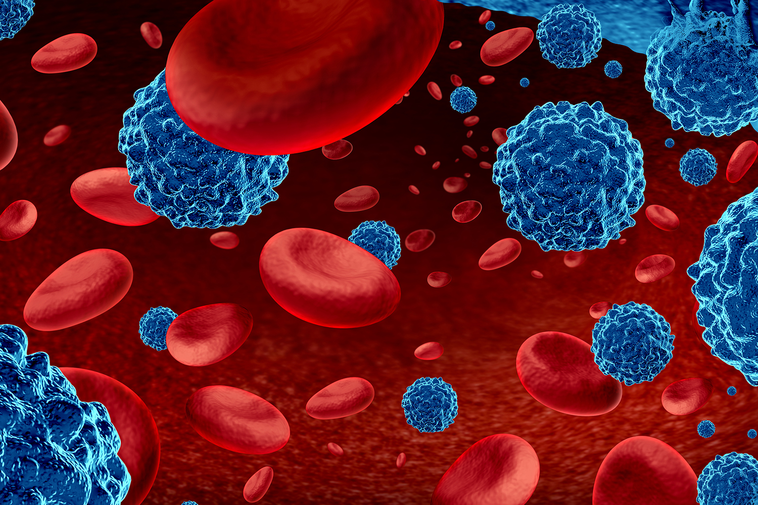 12 Blood Cancer Researchers Join Forces